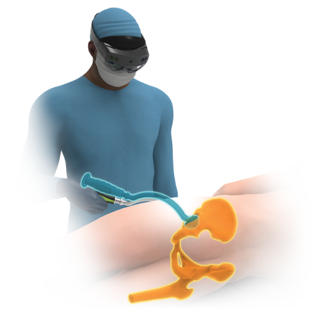 Zimmer Biomet’s HipInsight™ System